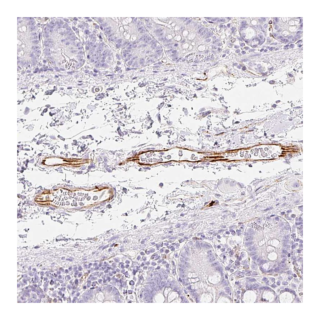 Atlas Antibodies Anti-ZNF689 Antibody