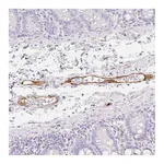 Atlas Antibodies Anti-ZNF689 Antibody