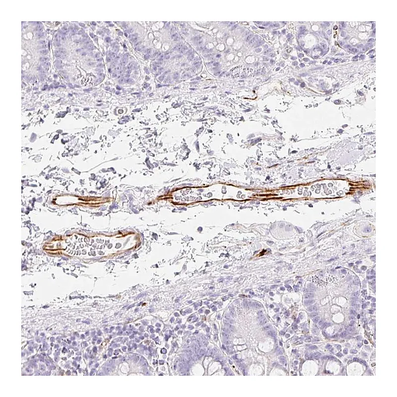 Atlas Antibodies Anti-ZNF689 Antibody