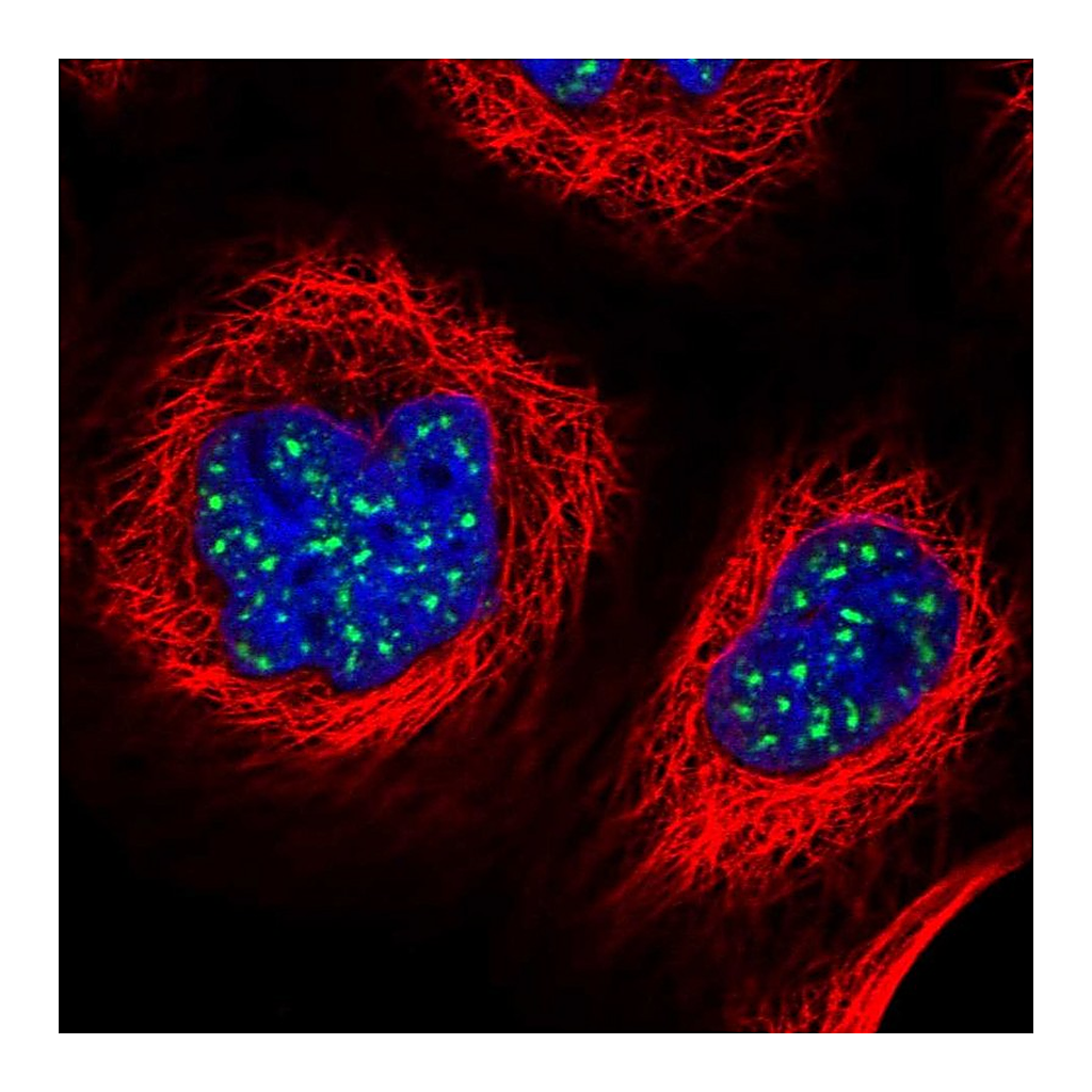 Atlas Antibodies Anti-ZNF695 Antibody