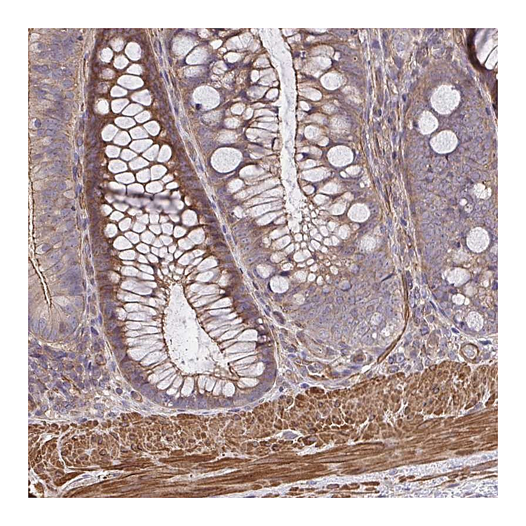 Atlas Antibodies Anti-ZNF696 Antibody