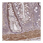 Atlas Antibodies Anti-ZNF696 Antibody