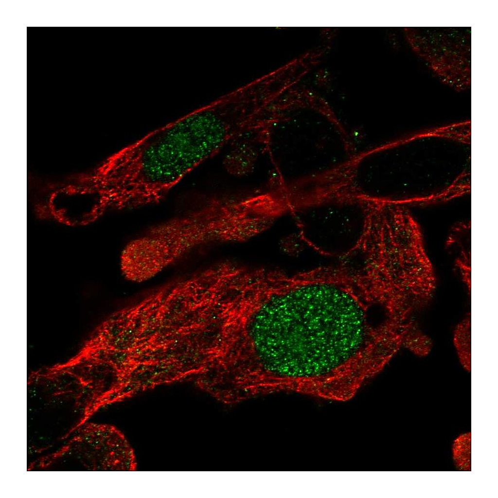 Atlas Antibodies Anti-ZNF696 Antibody