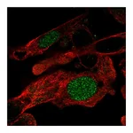 Atlas Antibodies Anti-ZNF696 Antibody