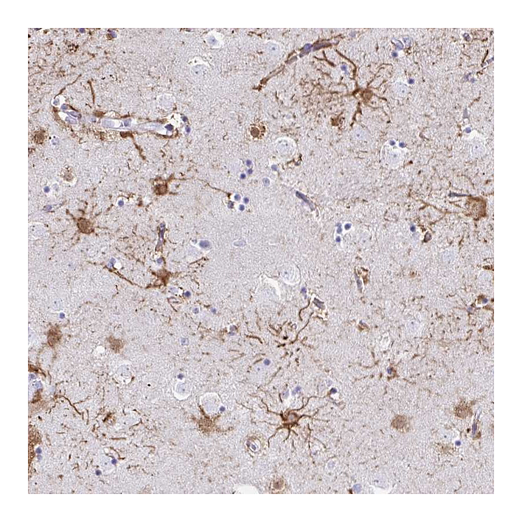 Atlas Antibodies Anti-ZNF699 Antibody