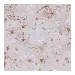 Atlas Antibodies Anti-ZNF699 Antibody