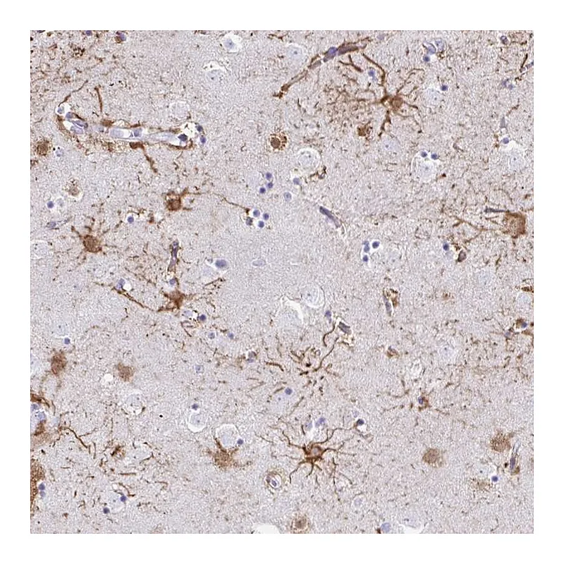 Atlas Antibodies Anti-ZNF699 Antibody