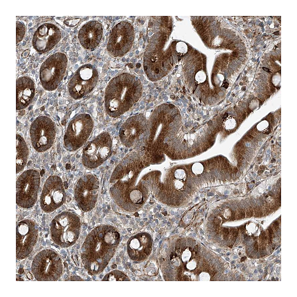 Atlas Antibodies Anti-ZNF7 Antibody