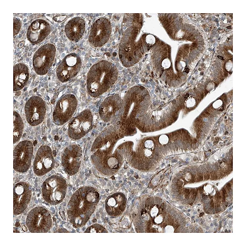 Atlas Antibodies Anti-ZNF7 Antibody