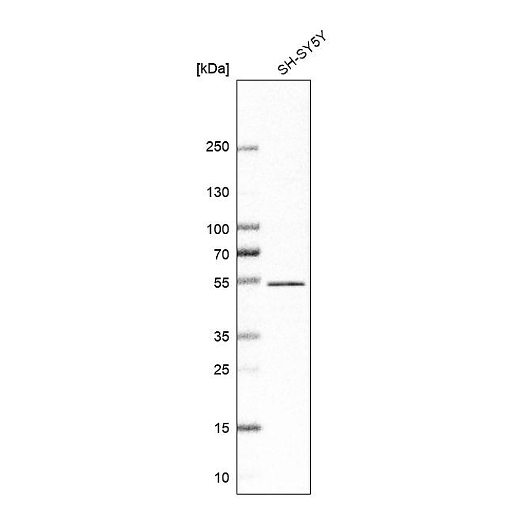 Atlas Antibodies Anti-ZNF704 Antibody
