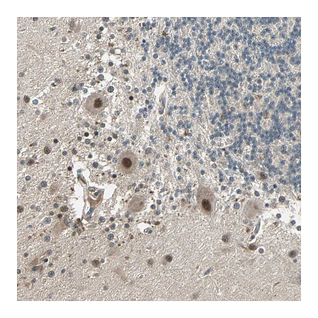 Atlas Antibodies Anti-ZNF701 Antibody