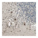 Atlas Antibodies Anti-ZNF701 Antibody