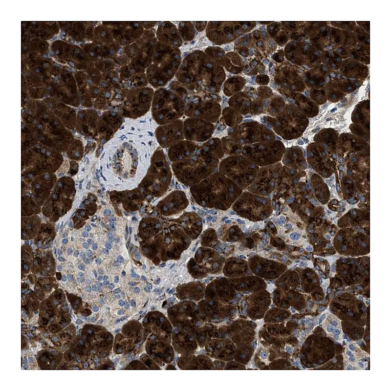 Atlas Antibodies Anti-ZNF70 Antibody