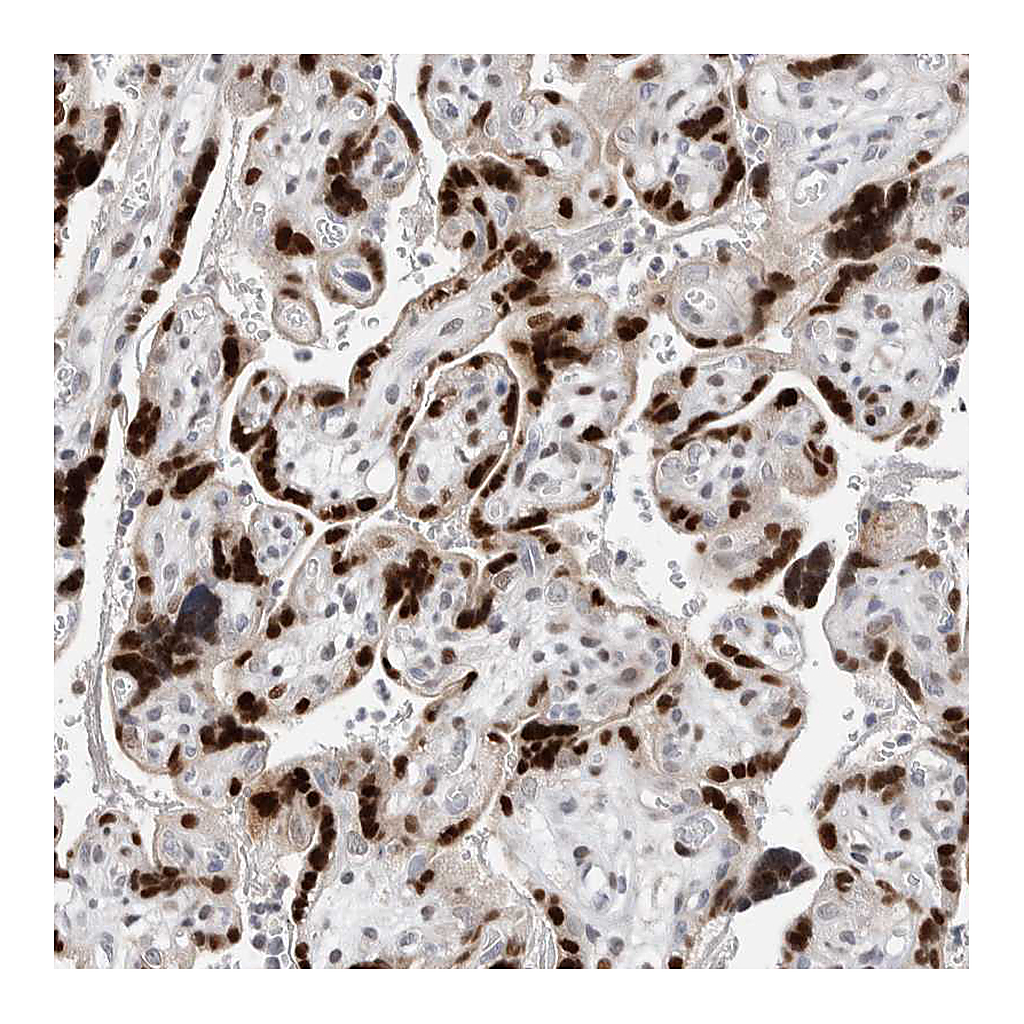 Atlas Antibodies Anti-ZNF703 Antibody