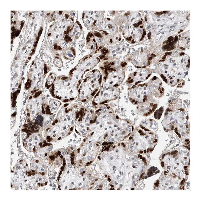 Atlas Antibodies Anti-ZNF703 Antibody