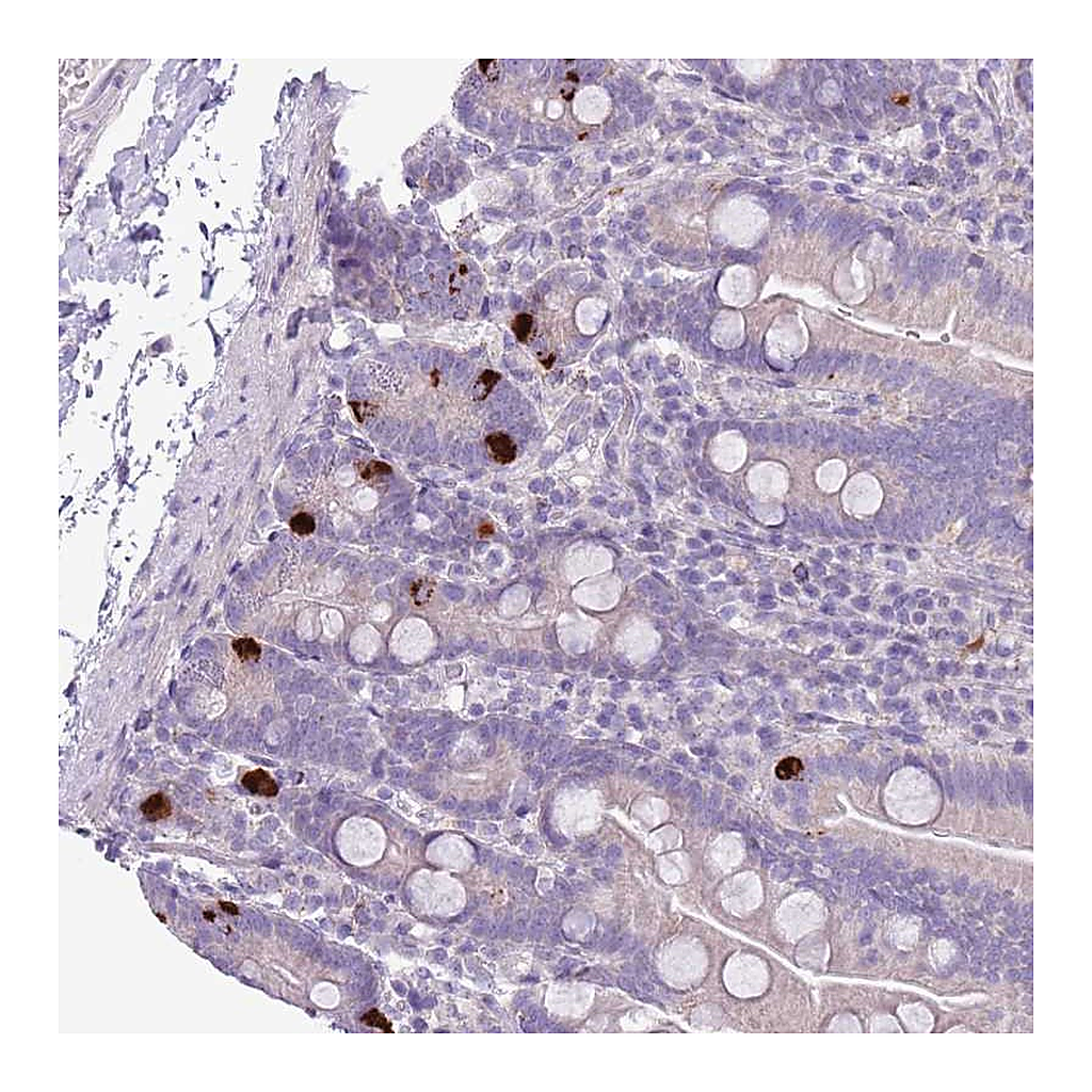 Atlas Antibodies Anti-ZNF697 Antibody