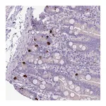 Atlas Antibodies Anti-ZNF697 Antibody