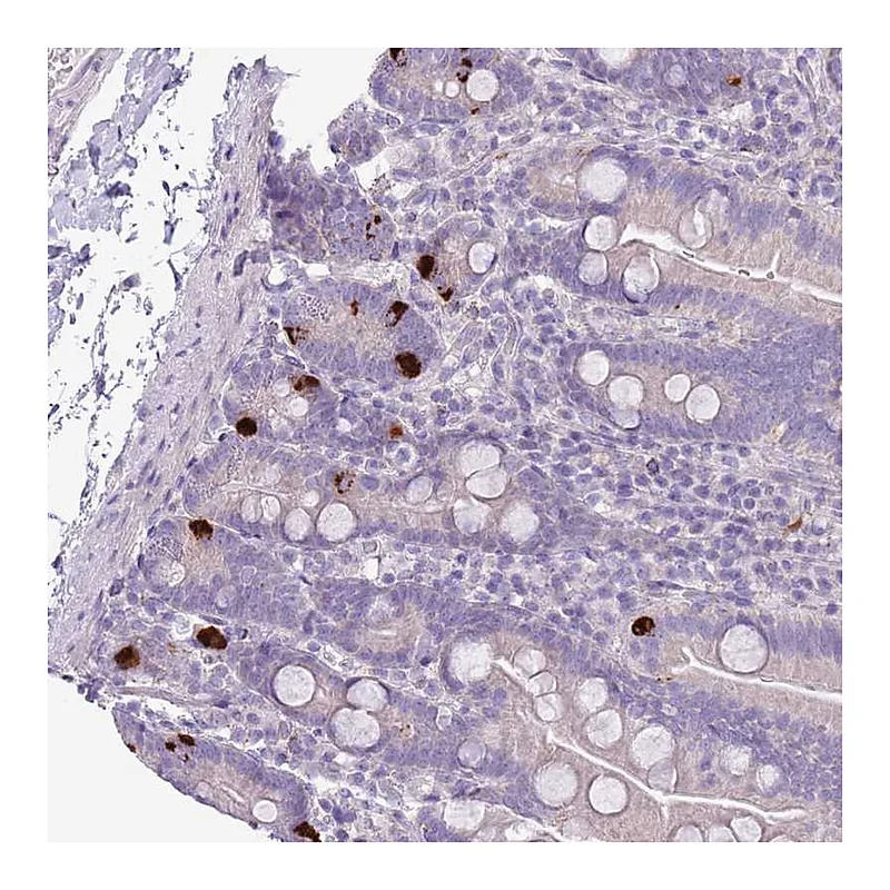 Atlas Antibodies Anti-ZNF697 Antibody