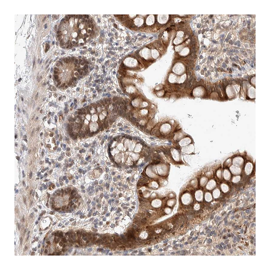 Atlas Antibodies Anti-ZNF704 Antibody