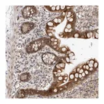 Atlas Antibodies Anti-ZNF704 Antibody