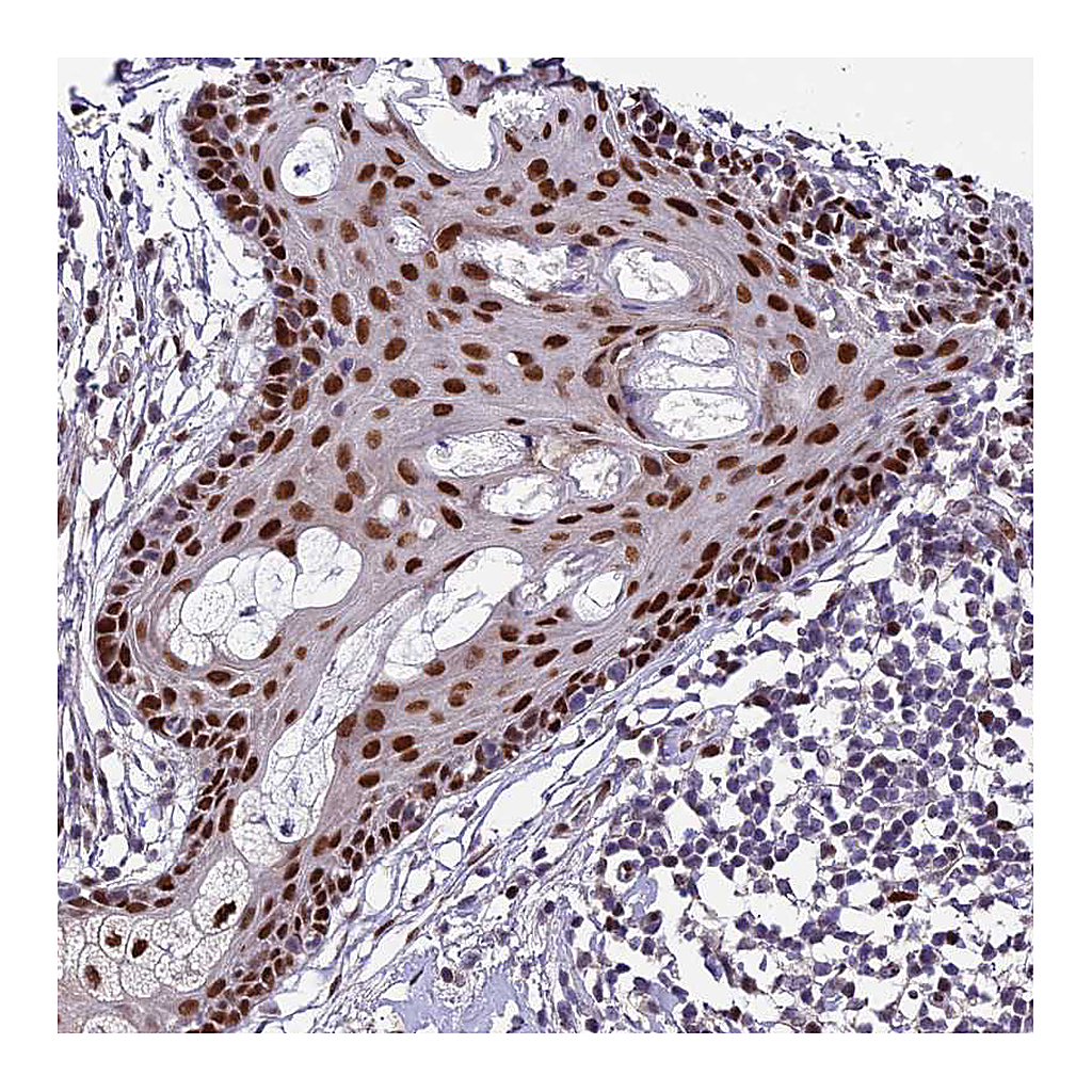 Atlas Antibodies Anti-ZNF707 Antibody