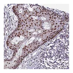 Atlas Antibodies Anti-ZNF707 Antibody