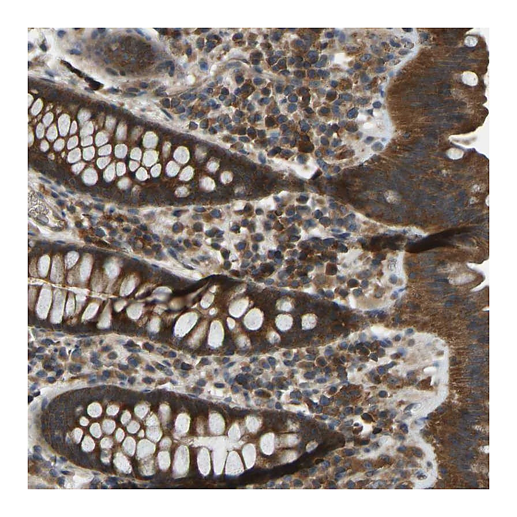Atlas Antibodies Anti-ZNF71 Antibody