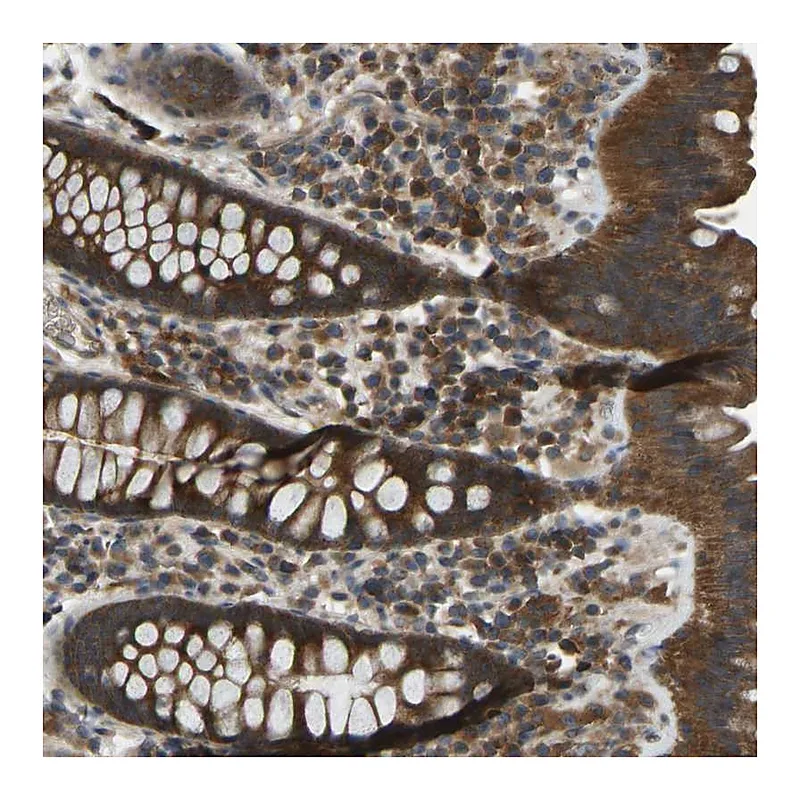 Atlas Antibodies Anti-ZNF71 Antibody