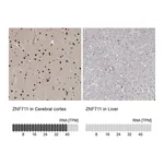 Atlas Antibodies Anti-ZNF711 Antibody