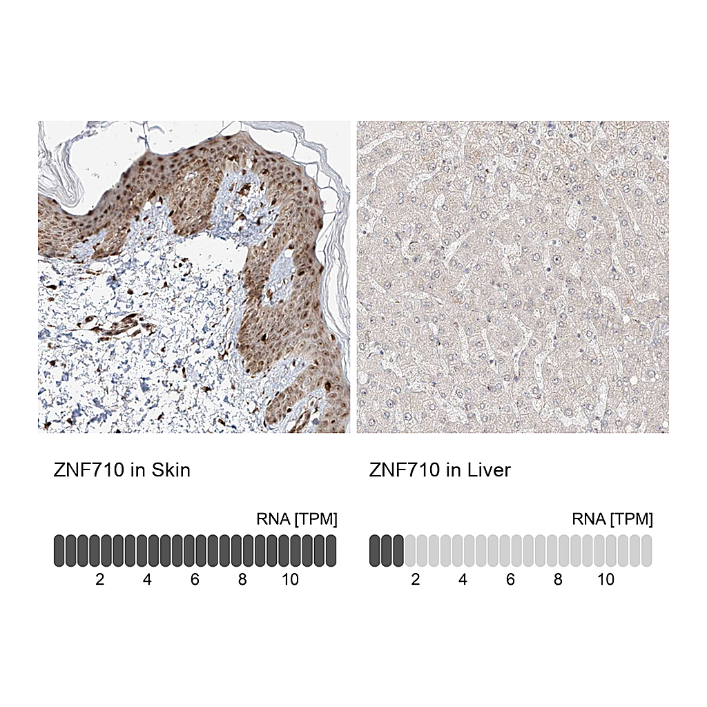 Atlas Antibodies Anti-ZNF710 Antibody