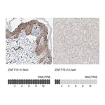 Atlas Antibodies Anti-ZNF710 Antibody
