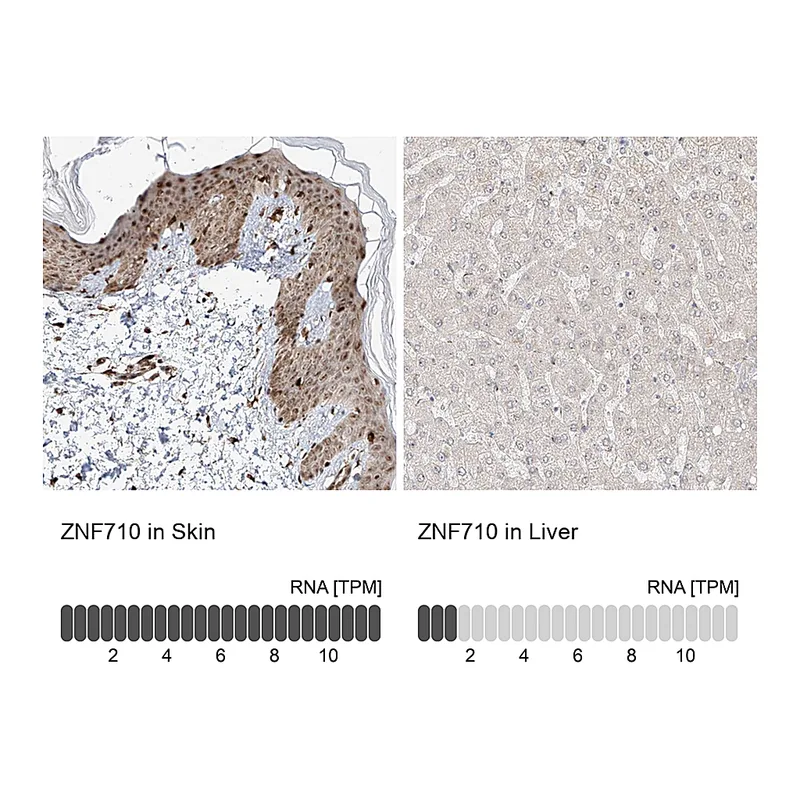 Atlas Antibodies Anti-ZNF710 Antibody
