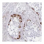 Atlas Antibodies Anti-ZNF713 Antibody