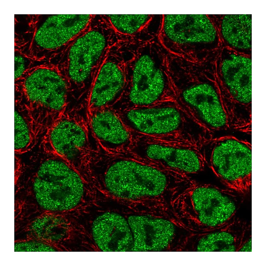 Atlas Antibodies Anti-ZNF709 Antibody
