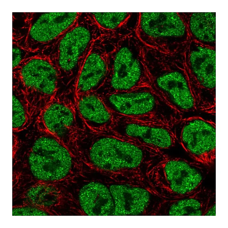 Atlas Antibodies Anti-ZNF709 Antibody