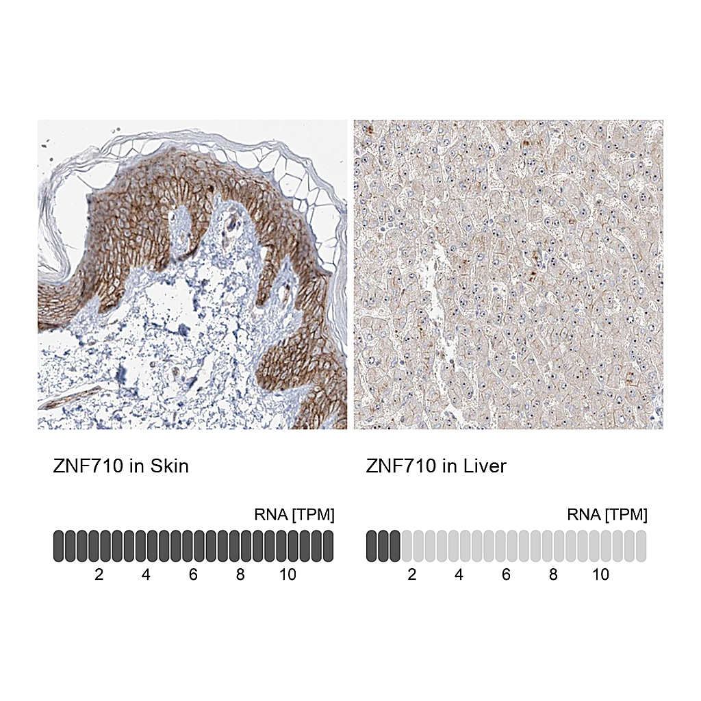 Atlas Antibodies Anti-ZNF710 Antibody