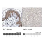 Atlas Antibodies Anti-ZNF710 Antibody