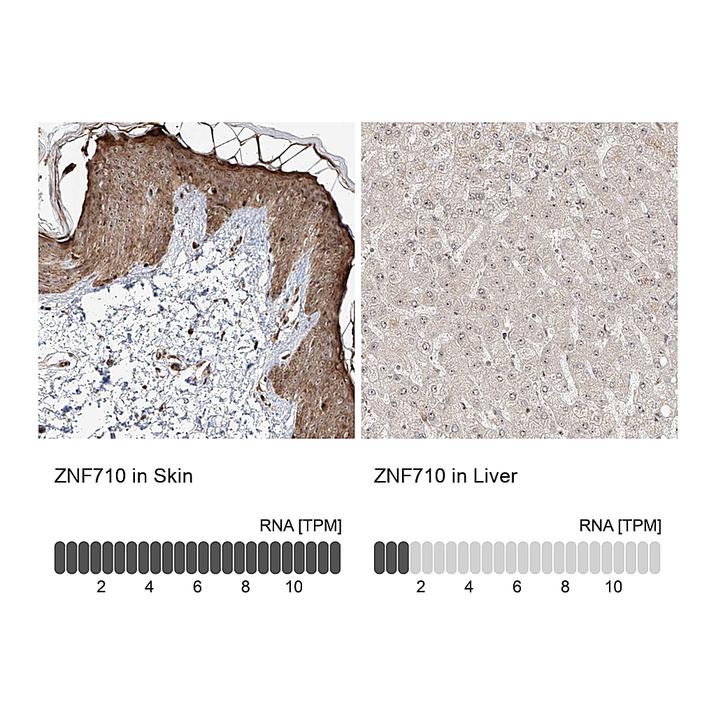 Atlas Antibodies Anti-ZNF710 Antibody