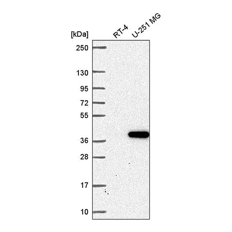 Atlas Antibodies Anti-ZNF713 Antibody