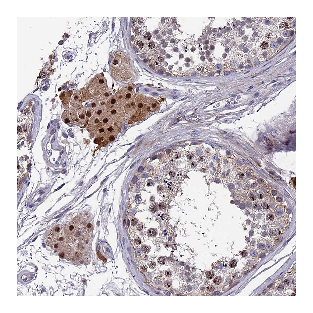 Atlas Antibodies Anti-ZNF717 Antibody