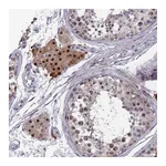 Atlas Antibodies Anti-ZNF717 Antibody