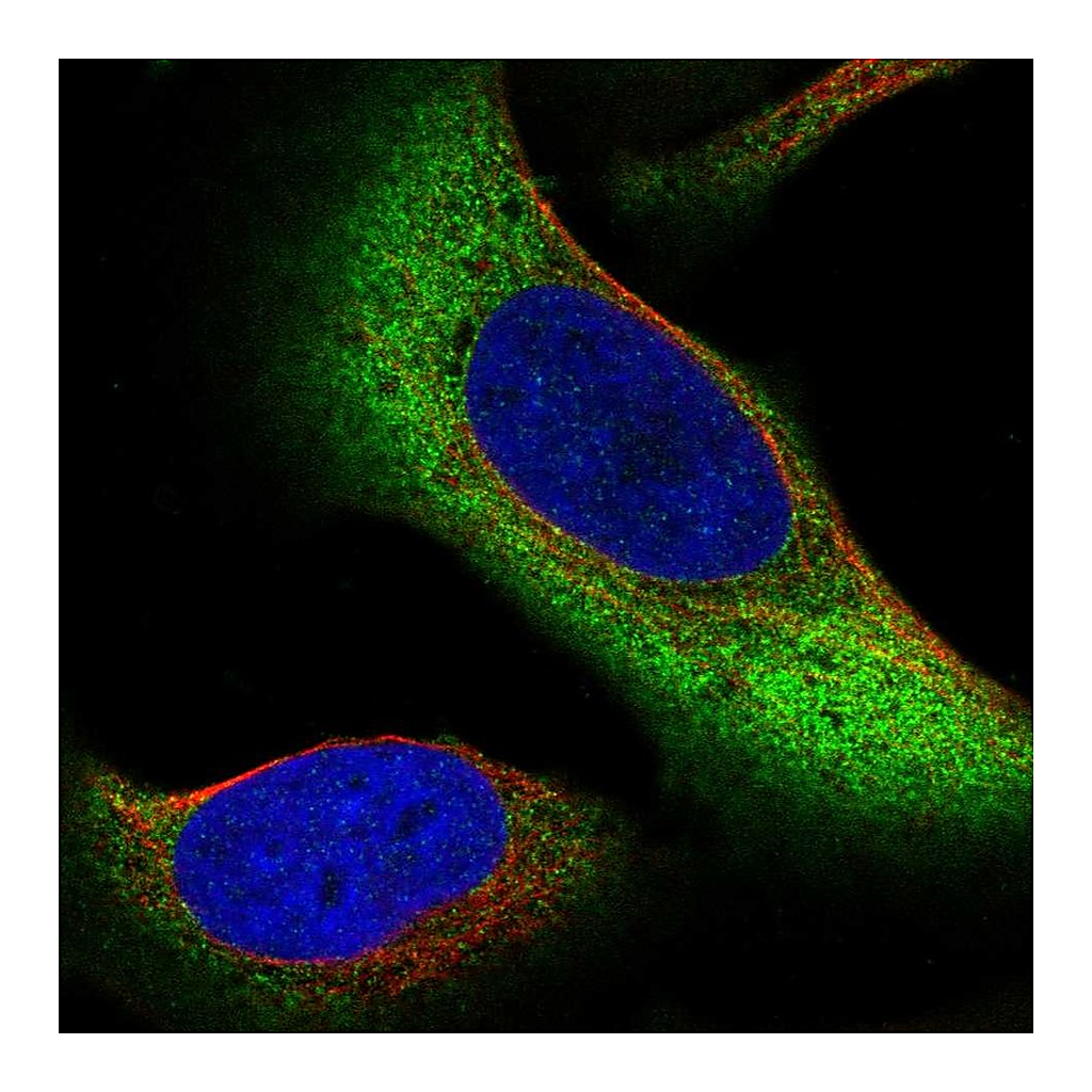 Atlas Antibodies Anti-ZNF721 Antibody