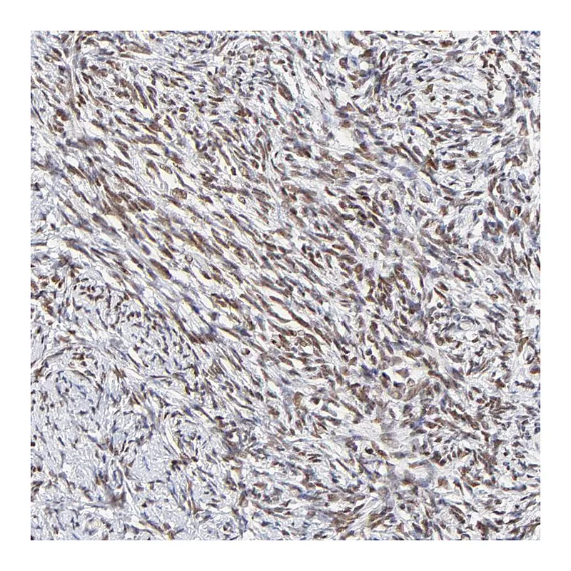 Atlas Antibodies Anti-ZNF74 Antibody