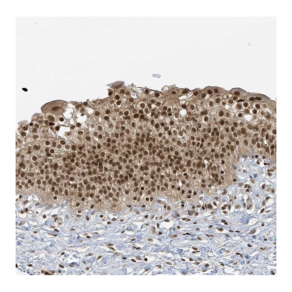 Atlas Antibodies Anti-ZNF740 Antibody