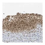 Atlas Antibodies Anti-ZNF740 Antibody