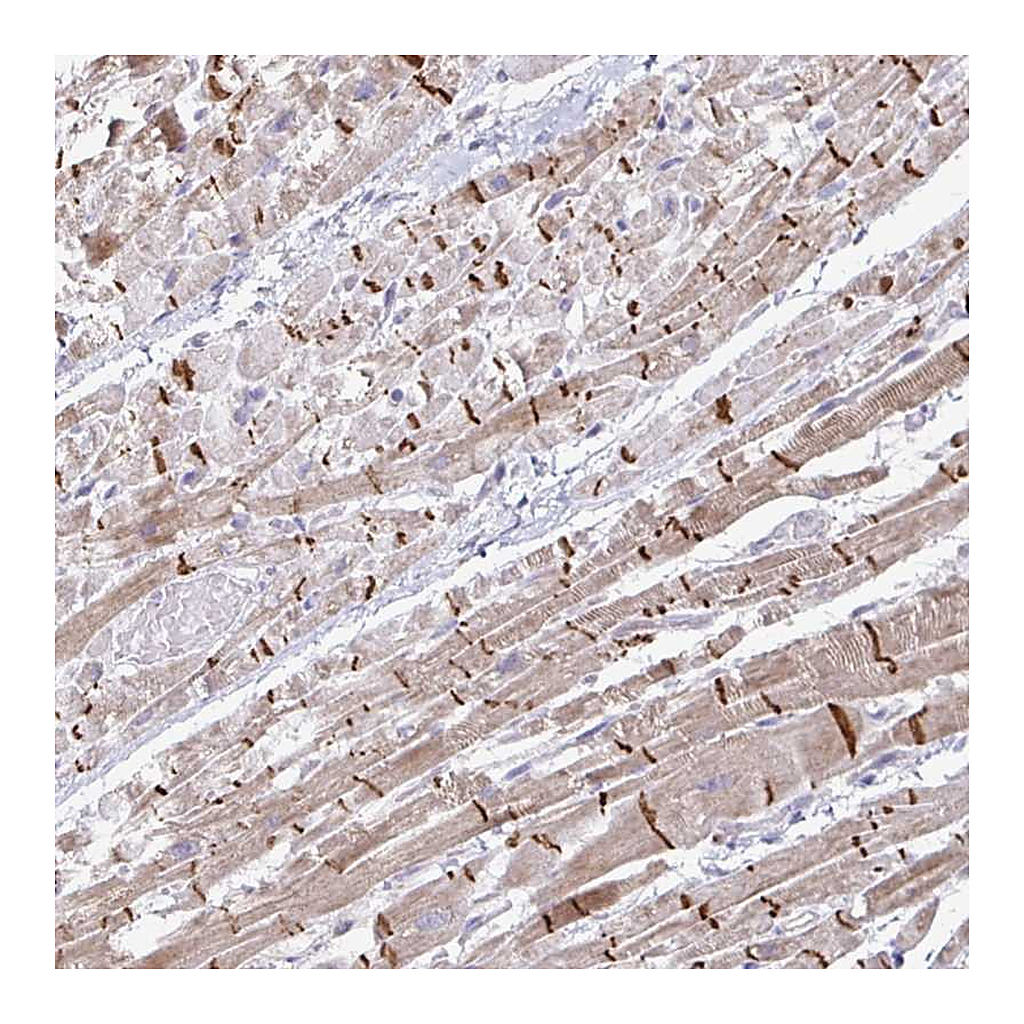 Atlas Antibodies Anti-ZNF736 Antibody