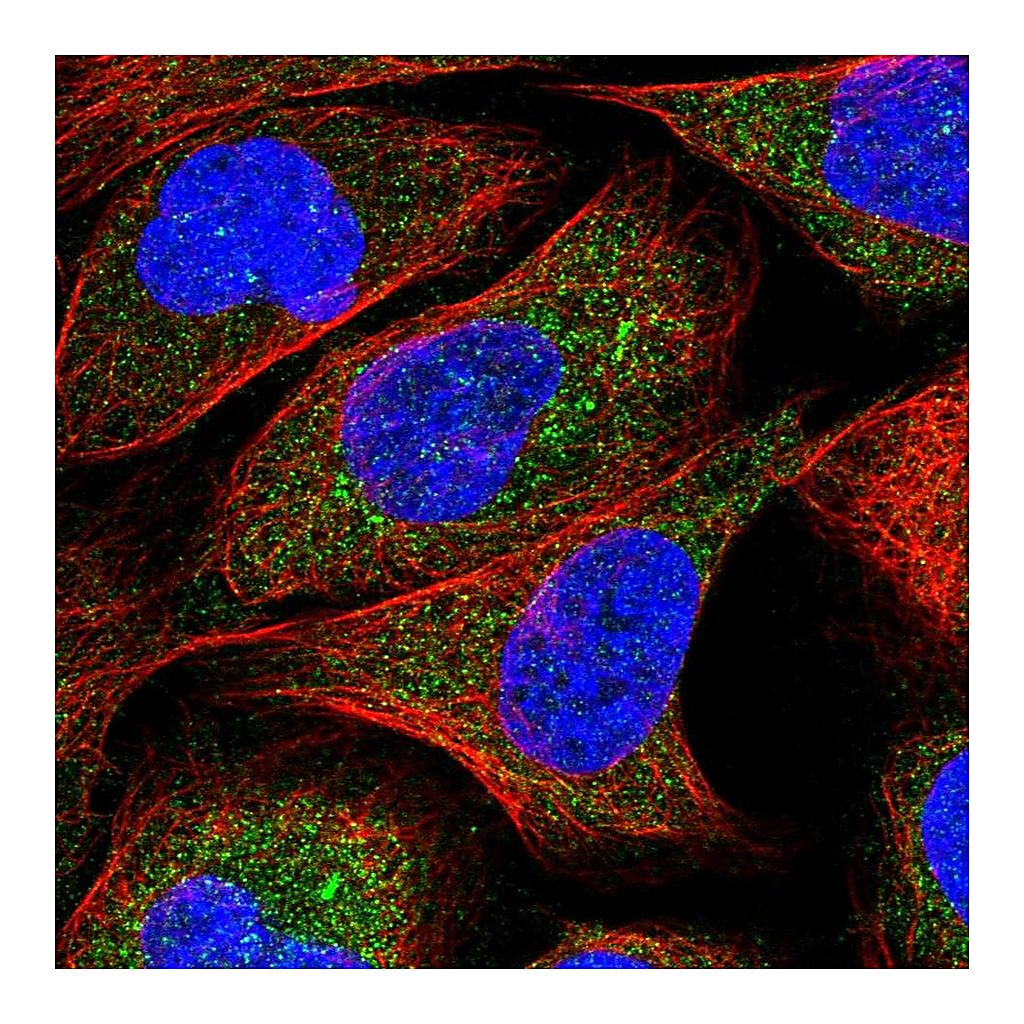 Atlas Antibodies Anti-ZNF720 Antibody
