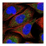 Atlas Antibodies Anti-ZNF720 Antibody