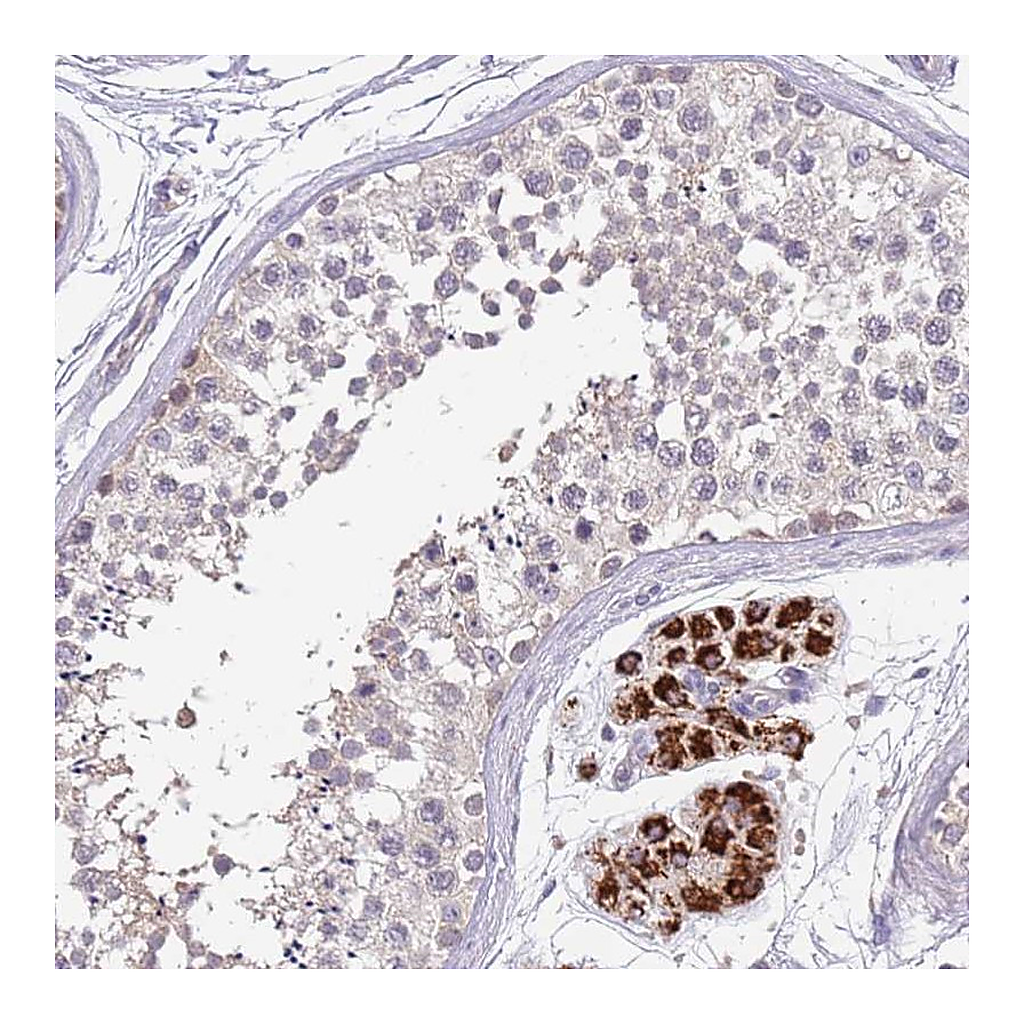 Atlas Antibodies Anti-ZNF746 Antibody