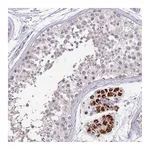 Atlas Antibodies Anti-ZNF746 Antibody